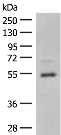 Rabbit Polyclonal Antibody to SLC2A3