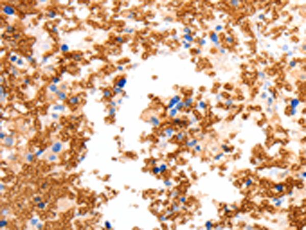 Rabbit Polyclonal Antibody to SLC2A5