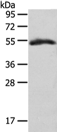 Rabbit Polyclonal Antibody to GLRA1