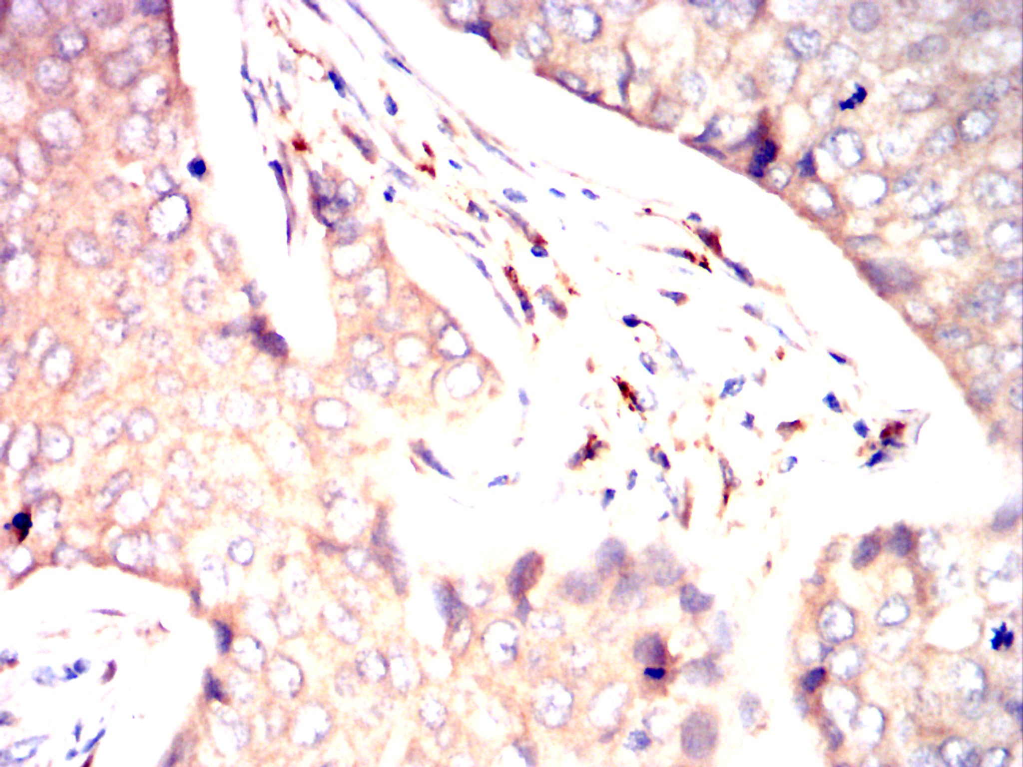 Mouse Monoclonal Antibody to CD116