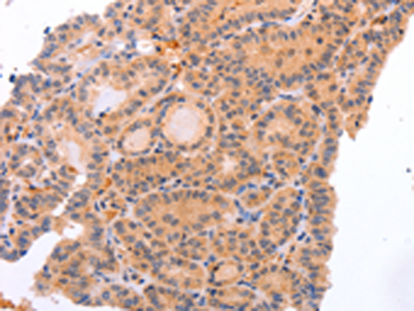 Rabbit Polyclonal Antibody to NR3C1