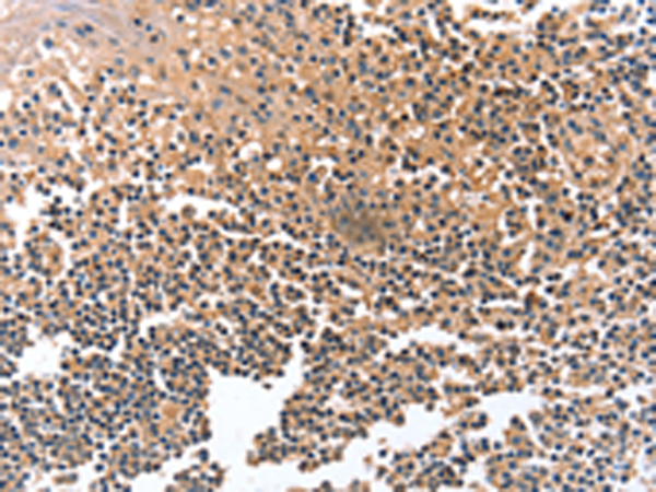 Rabbit Polyclonal Antibody to GRB10