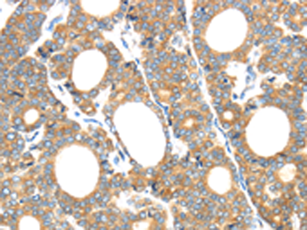 Rabbit Polyclonal Antibody to GZMK