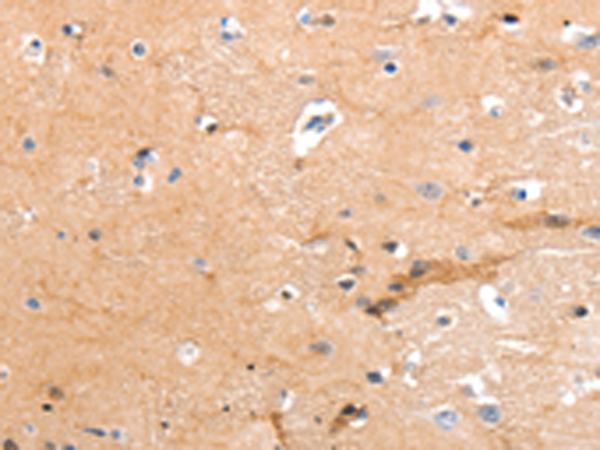Rabbit Polyclonal Antibody to ADGRG2
