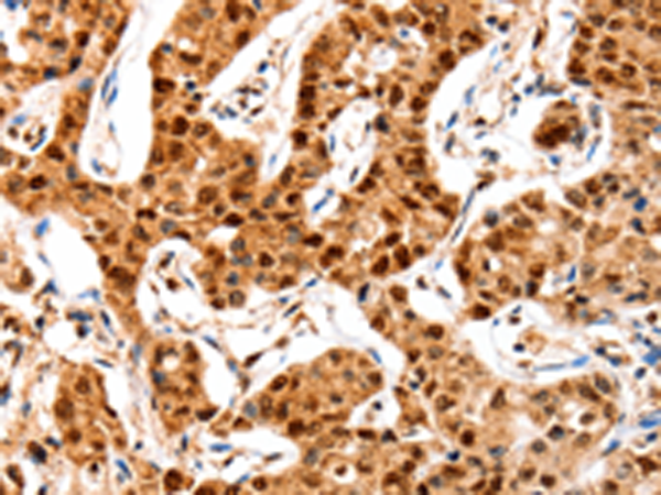 Rabbit Polyclonal Antibody to GRM4