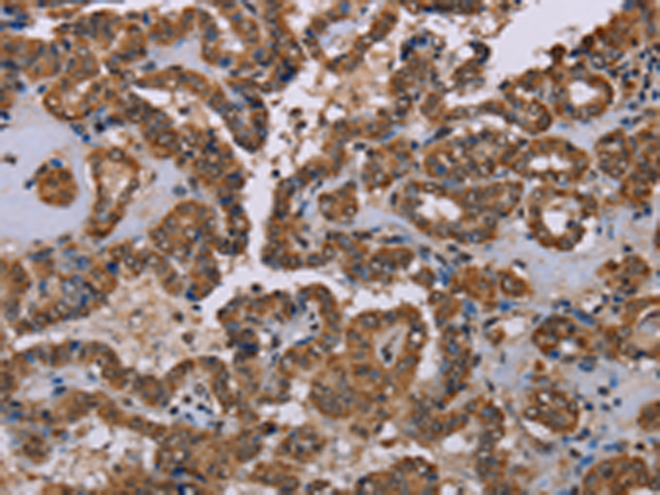 Rabbit Polyclonal Antibody to GRK1