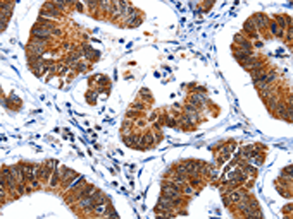 Rabbit Polyclonal Antibody to GSK3A