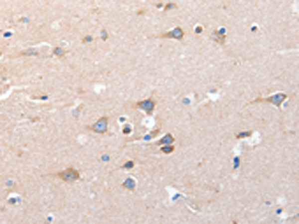 Rabbit Polyclonal Antibody to KCNH8