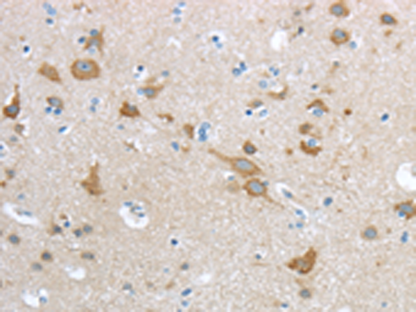 Rabbit Polyclonal Antibody to HCN4