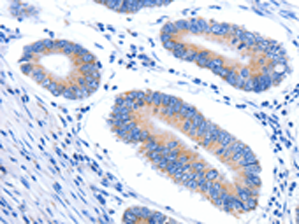 Rabbit Polyclonal Antibody to HINT2