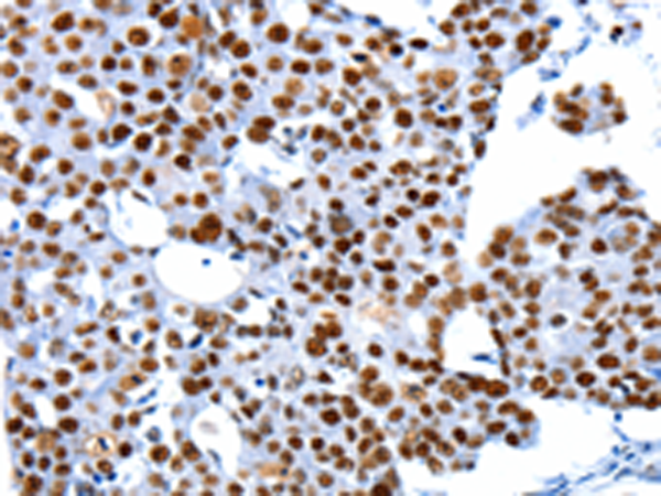 Rabbit Polyclonal Antibody to HDAC2