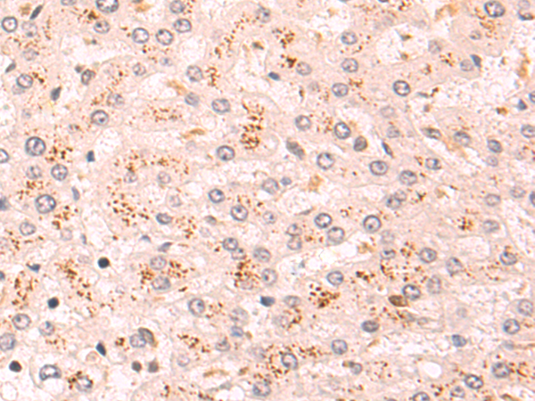 Rabbit Polyclonal Antibody to HDAC4
