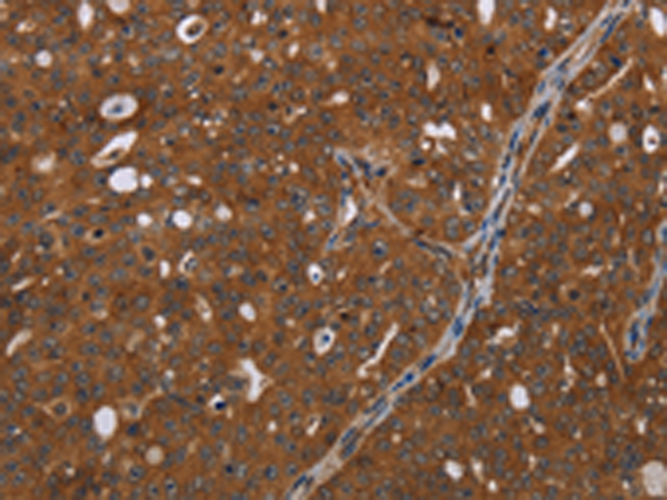 Rabbit Polyclonal Antibody to HDAC7