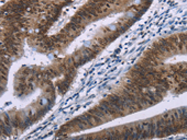 Rabbit Polyclonal Antibody to HMGA1