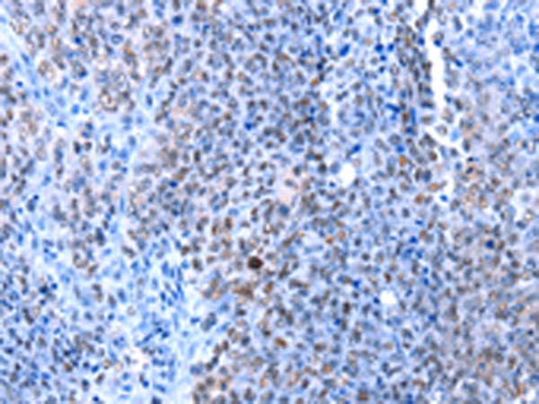 Rabbit Polyclonal Antibody to HMGB1