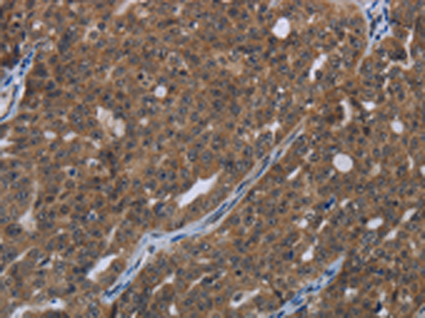 Rabbit Polyclonal Antibody to HOXC8