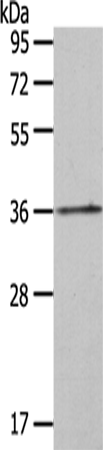 Rabbit Polyclonal Antibody to HOXA11