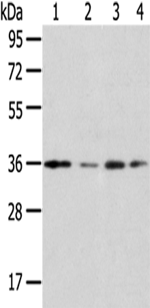 Rabbit Polyclonal Antibody to HOXD13