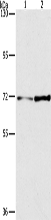 Rabbit Polyclonal Antibody to PPP1R13L