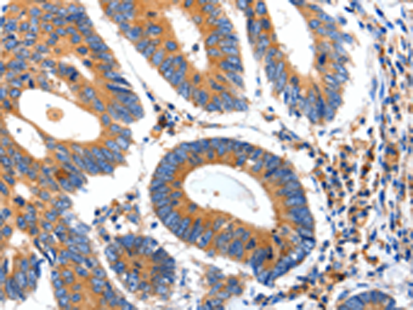 Rabbit Polyclonal Antibody to IGFBP7