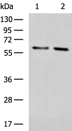 Rabbit Polyclonal Antibody to IL15RA