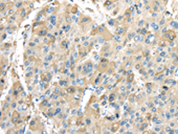 Rabbit Polyclonal Antibody to INHBB