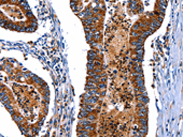 Rabbit Polyclonal Antibody to ITGA7