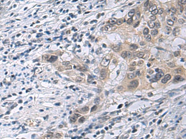 Rabbit Polyclonal Antibody to IRS4