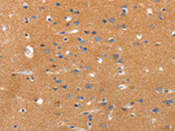 Rabbit Polyclonal Antibody to JAK2