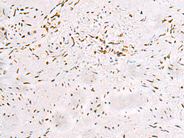 Rabbit Polyclonal Antibody to MKI67