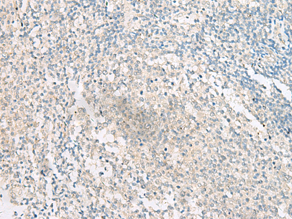 Rabbit Polyclonal Antibody to KISS1