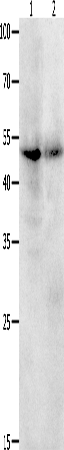 Rabbit Polyclonal Antibody to KLF5