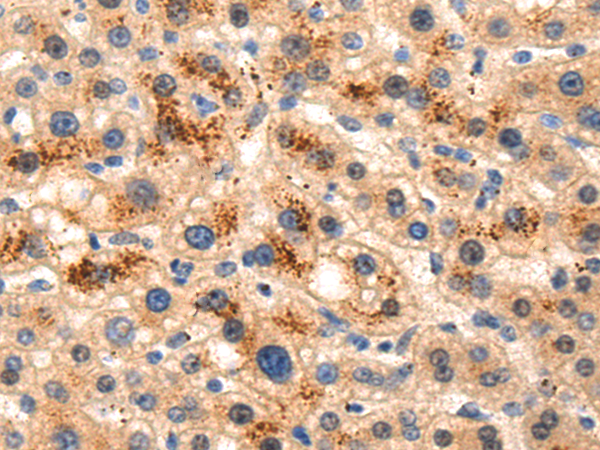 Rabbit Polyclonal Antibody to LAMA3
