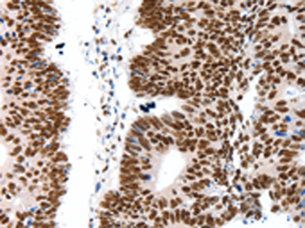 Rabbit Polyclonal Antibody to LIFR