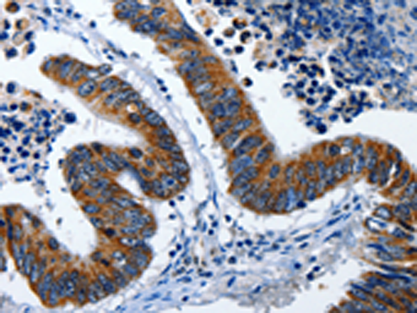 Rabbit Polyclonal Antibody to LAMA1