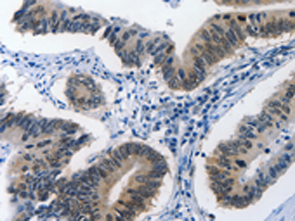 Rabbit Polyclonal Antibody to BPIFB1