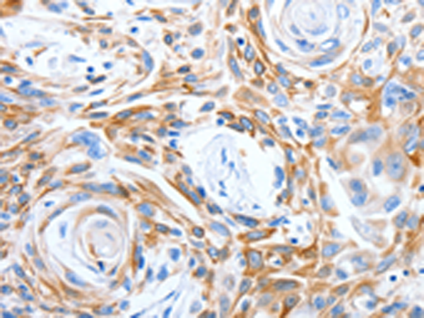 Rabbit Polyclonal Antibody to LRIG3