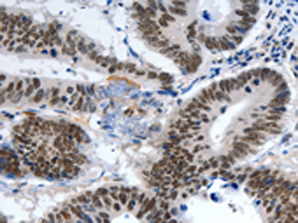 Rabbit Polyclonal Antibody to LRP5
