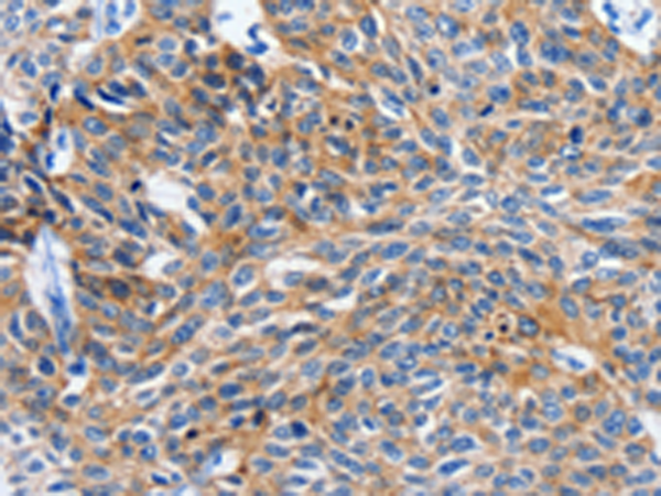 Rabbit Polyclonal Antibody to ITGAL