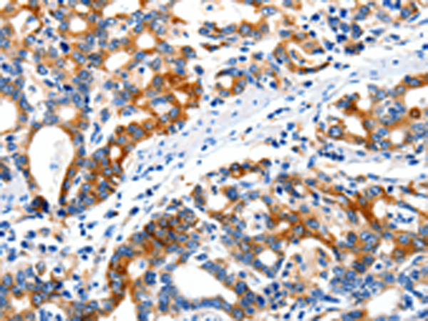 Rabbit Polyclonal Antibody to ITGAX