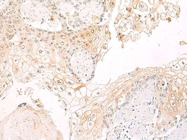 Rabbit Polyclonal Antibody to ITGAM