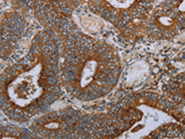 Rabbit Polyclonal Antibody to MAFF