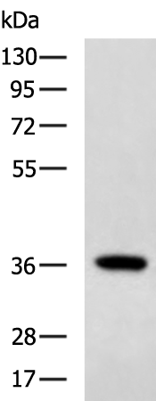 Rabbit Polyclonal Antibody to MAGEA2