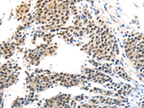 Rabbit Polyclonal Antibody to MAGEA6