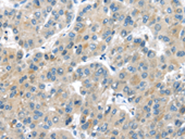 Rabbit Polyclonal Antibody to MASP2