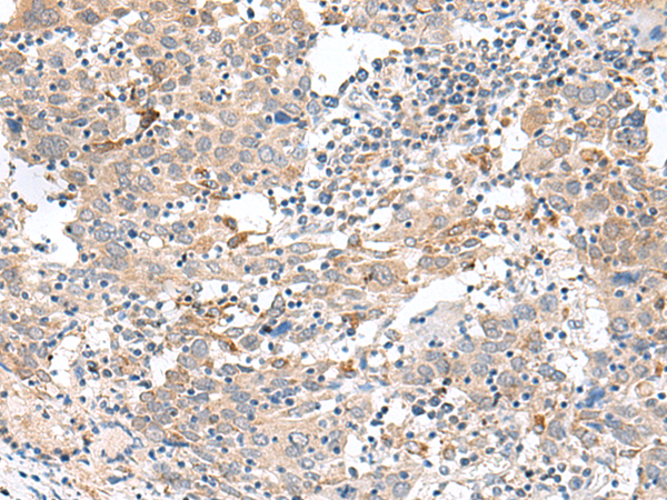 Rabbit Polyclonal Antibody to CCL8