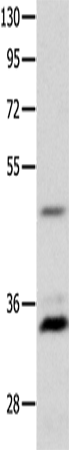 Rabbit Polyclonal Antibody to MC1R