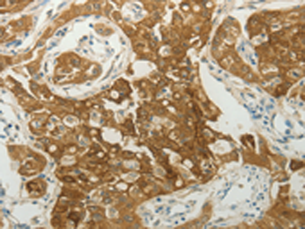 Rabbit Polyclonal Antibody to MC4R