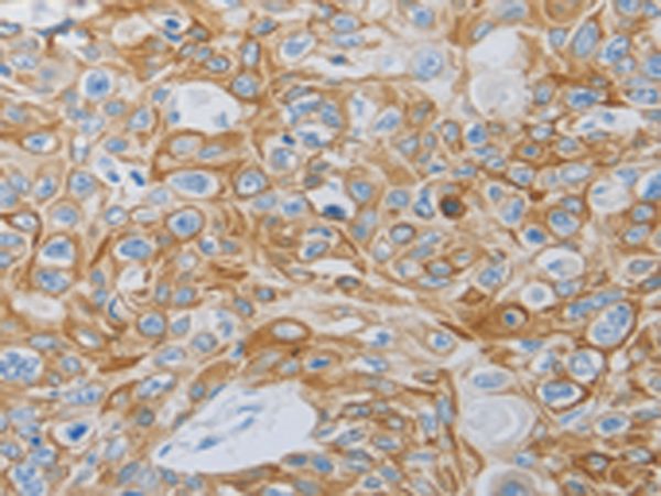 Rabbit Polyclonal Antibody to MC5R