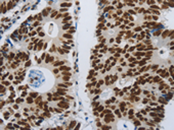 Rabbit Polyclonal Antibody to SLC16A14